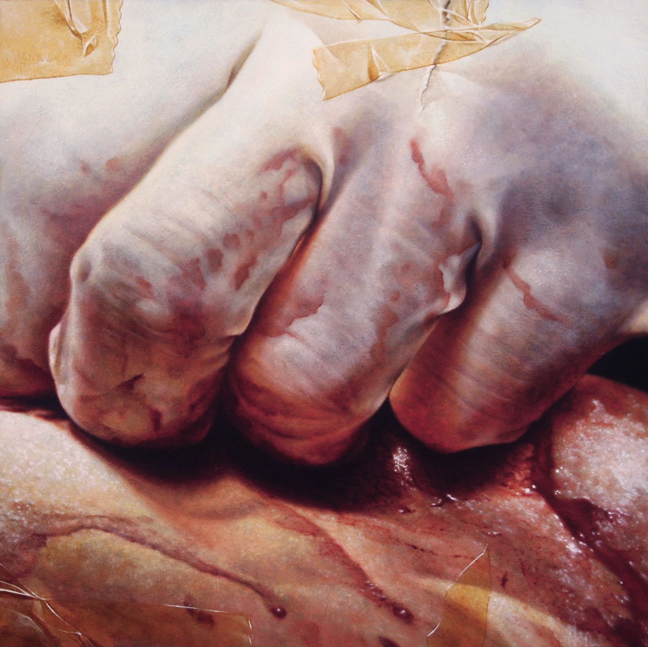 Close-up painting of a gloved surgeon's hand against a fleshy background.
