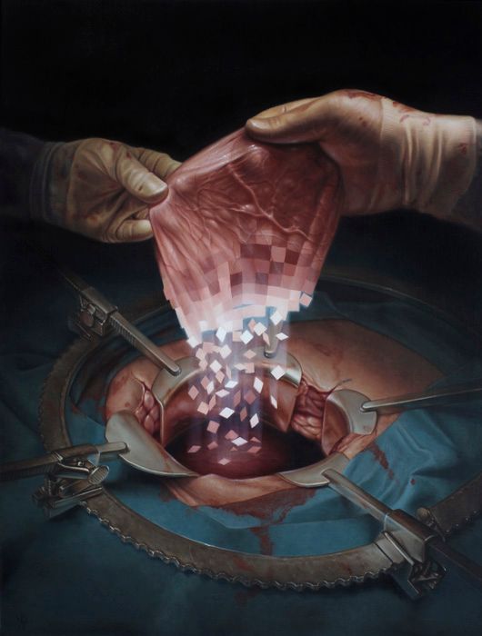 A dark oil painting depicts gloved hands holding translucent pink flesh fragmenting into pixels above a bloodied, retractor-held surgical opening.