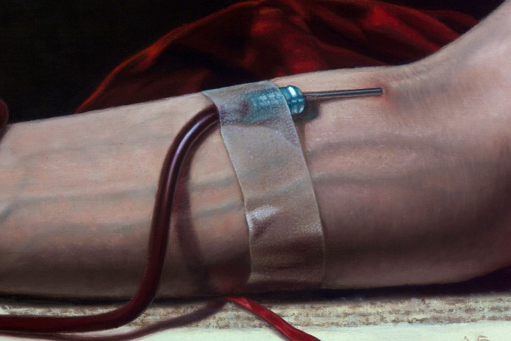 Close-up painting of a pale forearm with a taped intravenous needle and dark red tubing against black and crimson fabric.