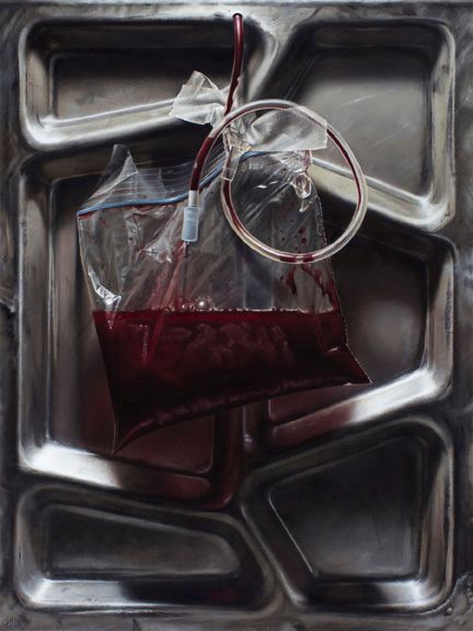 A clear ziploc bag half-filled with dark red liquid and coiled tubing rests against a reflective stainless-steel tray.