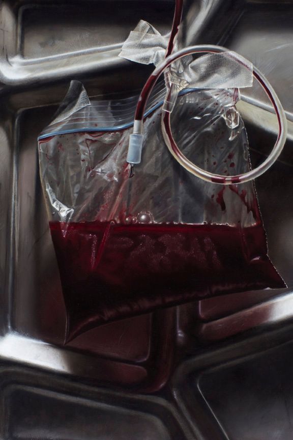 Close view of a transparent medical bag partially filled with dark red liquid, with looping tubes against a metallic background.