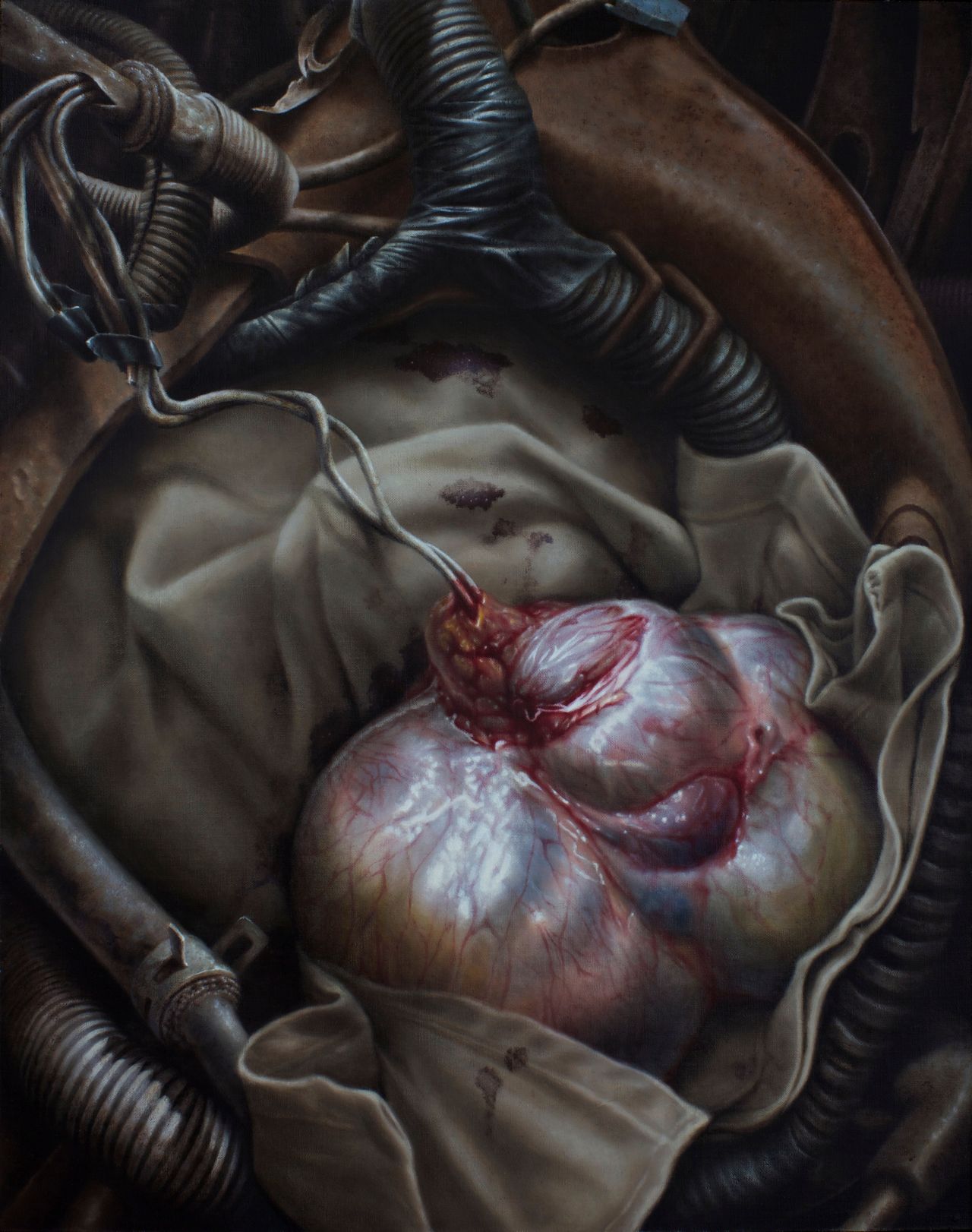 Close-up painting of a pale tumor amid dark ribbed hoses, brown fabric, metal fittings, and trailing wires.