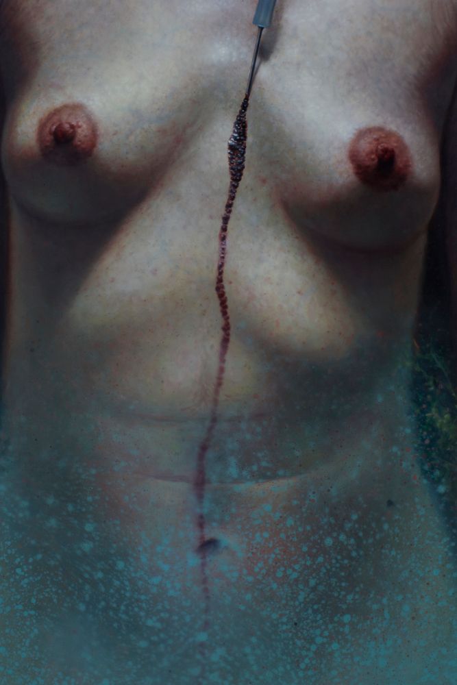 Close-up painting of a bare female torso with a blood collection needle dripping blood.