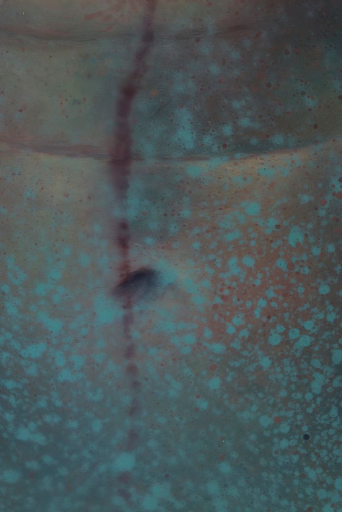 close up of woman's torso in mottled turquoise and gray, with scattered reddish speckles and a dark drip of blood descending near the center.
