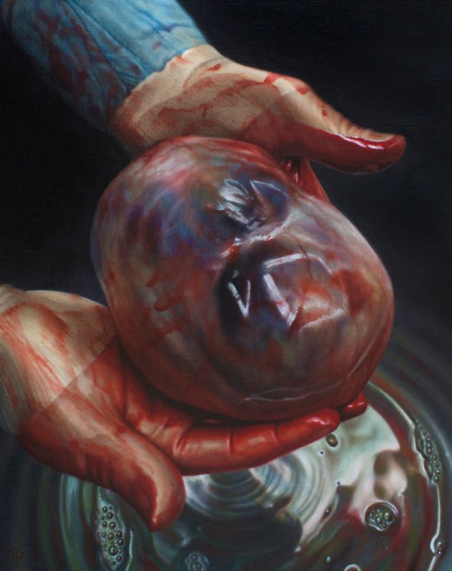 Close-up oil painting of blood-smeared hands cradling a glossy, rounded red-purple tumor mass above a reflective metal basin.