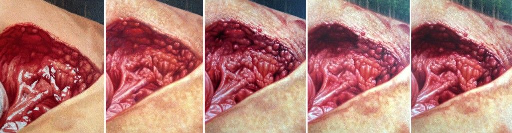 Wound progression.