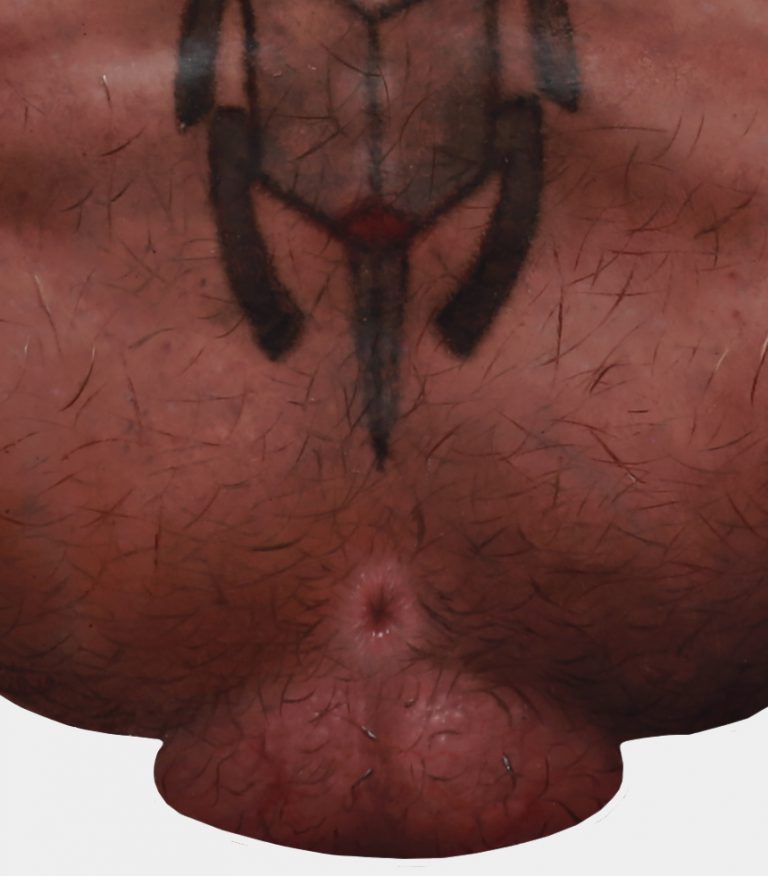 “Pest” (detail)