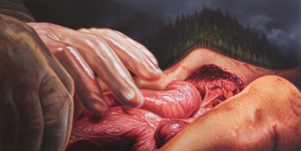 Transfiguration