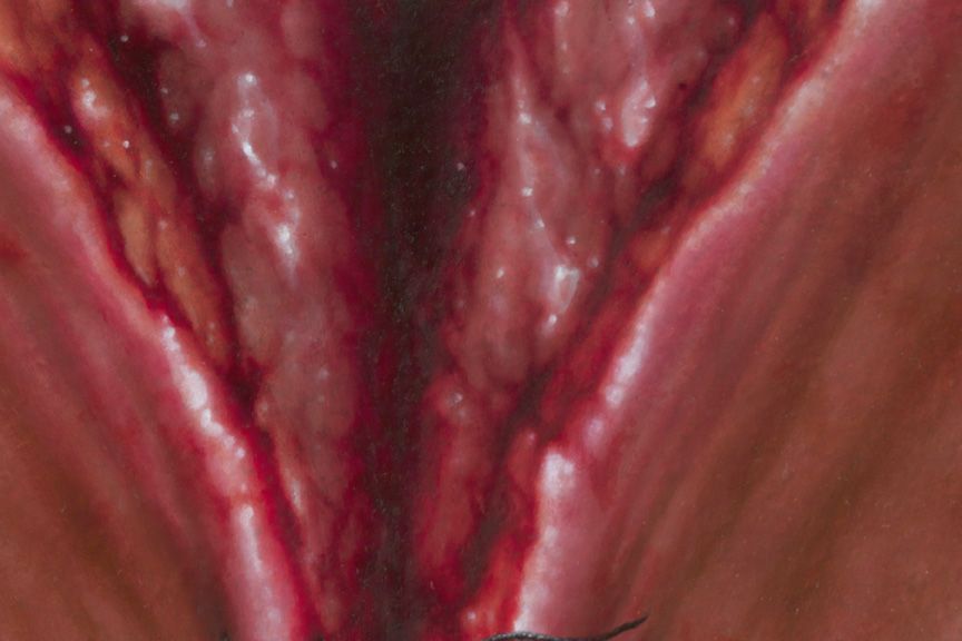 Heals All Wounds (detail)