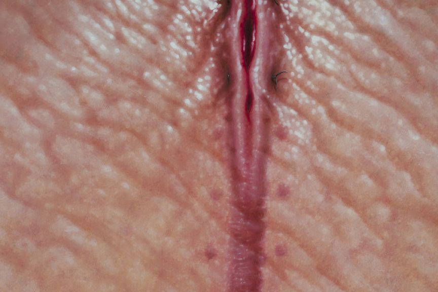 Heals All Wounds (detail)